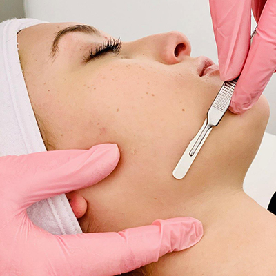 Revitalize Your Skin with Derma Scraping